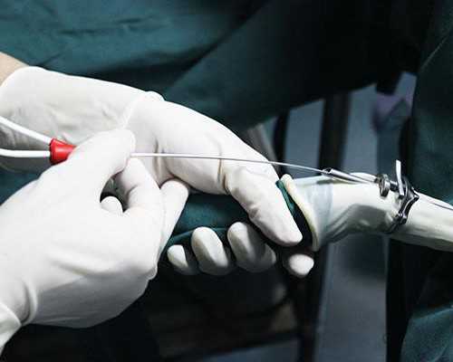 国内做供卵要多少钱,南宁试管生宝宝多少钱