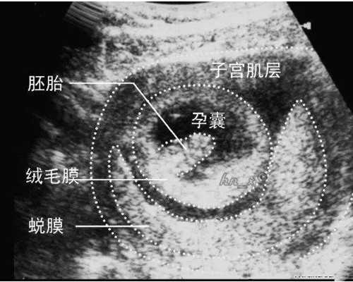 国内供卵试管地址,​试管婴儿移植后流产的原因解答，教你预防移植后流产的方法