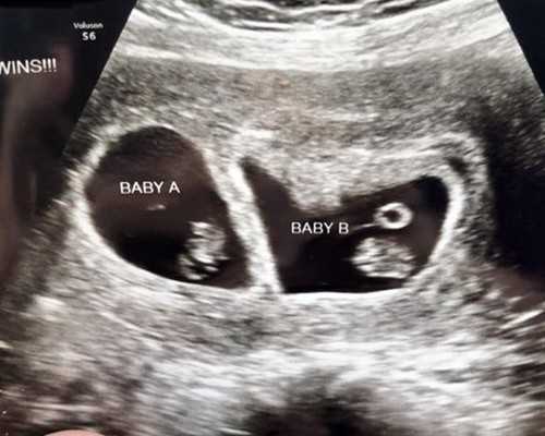 国内地下供卵机构名单,找个女人给我生个男孩要多少钱？