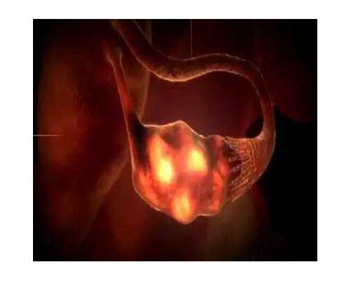 国内哪家有做供卵试管的医院,石家庄正规试管医院比较新排名,附过程及注意事项说明 国内哪家有做供卵试管的医院,石家庄正规试管医院比较新排名,附过程及注意事项说明