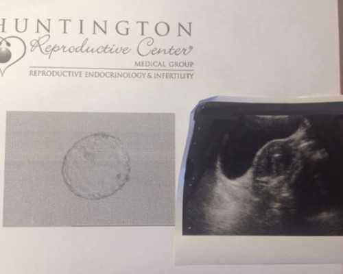 国内有哪些供卵机构名称,泰国试管A卵B怀常见问题汇总(抚养权、落户等一应解答)