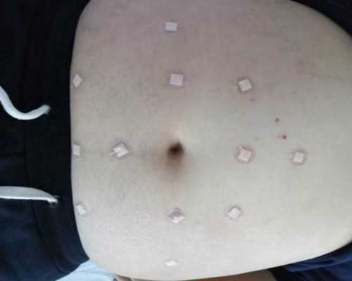 国内代怀机构,沧州市二医院试管婴儿胚胎 如何选择好的胚胎