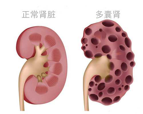 国内供卵源,月经不调对试管*率有影响吗看完你就明白了