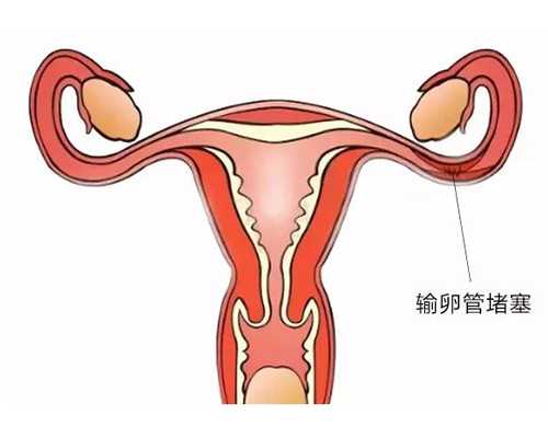 国内供卵价位查询,2025从国内去格鲁吉亚做三代试管*孩子需要多少钱
