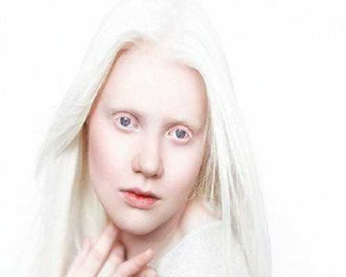 国内代怀贵不贵,试管促排卵时白带不拉丝不排卵?