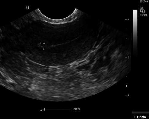 产前检查项目及费用谁有？怀孕4周要检查什么？ 供卵助孕咨询机构