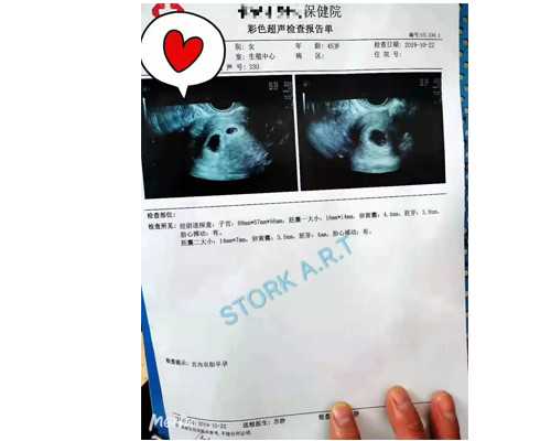 国内高龄试管供卵,试管婴儿是什么东西？不少人开始接受试管婴儿