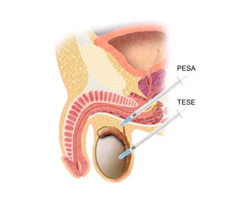 国内申请供卵需要多久,做试管胚胎差但可以移植？试管胚胎质量差可以养囊吗？