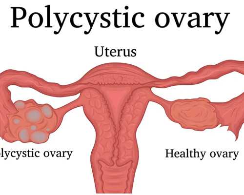 国内代怀,二代试管婴儿促排后只取了2个卵子移植胚胎的*率高吗