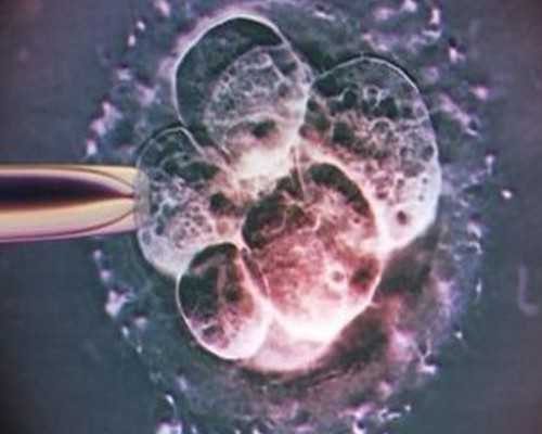 国内供卵哪里可以提供,试管婴儿双胎的什么条件，试管双胎要什么条件