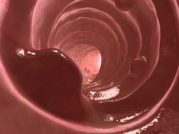 宫颈息肉切除手术方式~代孕总费用多少